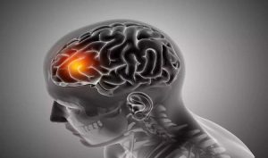 Understanding the Various Aspects of Brain Tumor