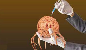 Most Innovative Medical Treatment for Brain Tumours