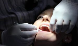 Treatment Options for Mouth Cancer by Stage
