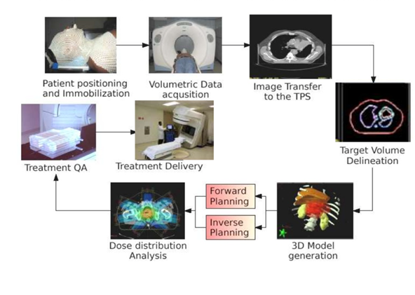 Steps in Radiation Treatment