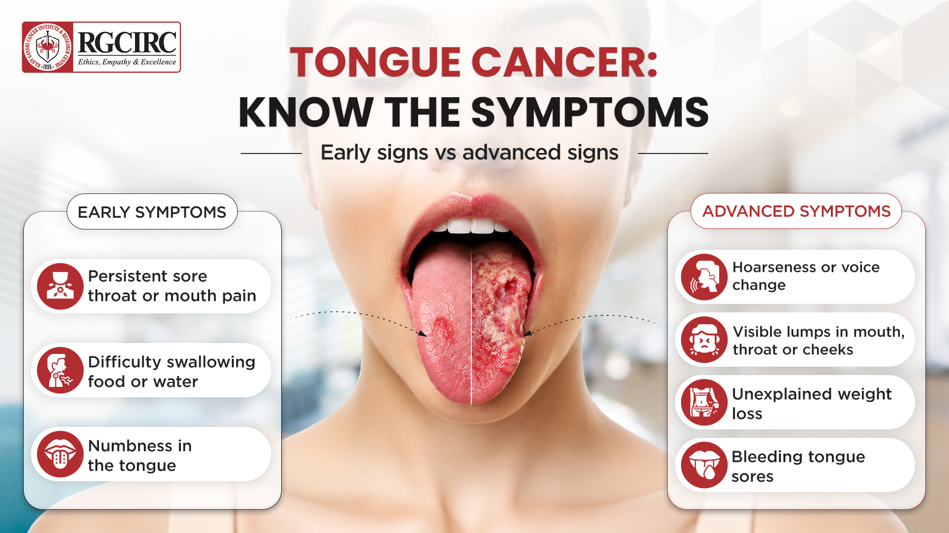 TONGUE CANCER KNOW THE SYMPTOMS