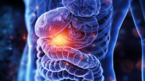 Abdominal Pain and Yellowing of Skin: Could It Be Cholangiocarcinoma?