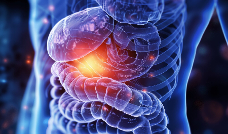 Cholangiocarcinoma ?> 