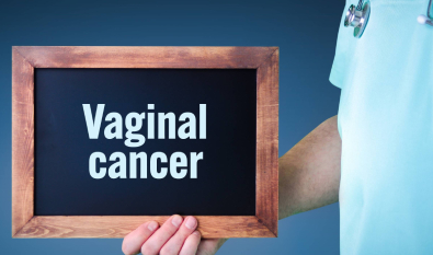 Understanding vaginal cancer with expert care and diagnosis at RGCIRC ? ?> 