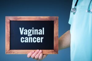 Understanding Vaginal Cancer: Symptoms, Causes, and Risk Factors