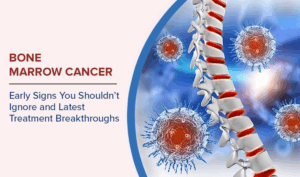 Bone Marrow Cancer: Early Signs You Shouldn’t Ignore and Latest Treatment Breakthroughs